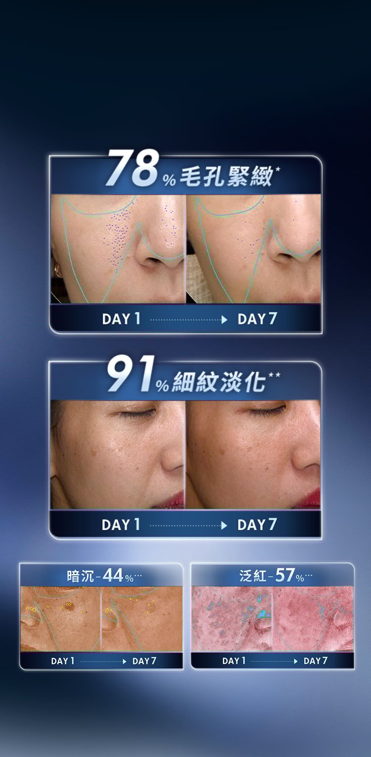 78%毛孔緊緻 91%細紋淡化 暗沉-44% 泛紅-57%
